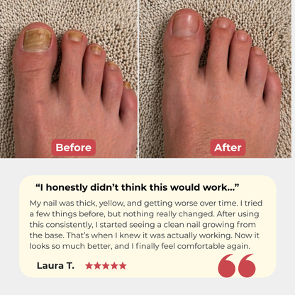 Nail Restore Pro™ – Deep Penetrating Antifungal Serum