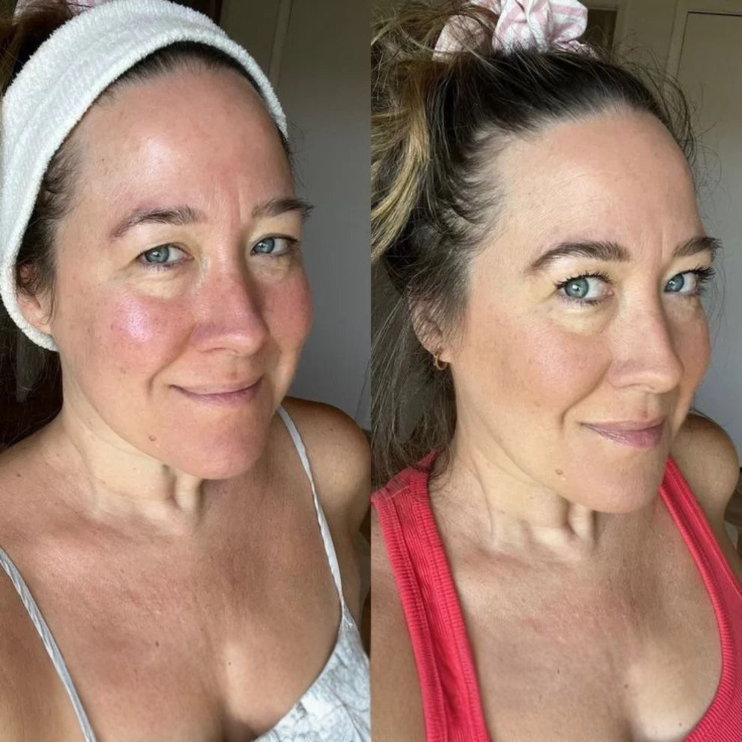 Aluxe Advanced Lift Serum
