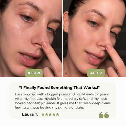 Holy Basil Bubble Mask™