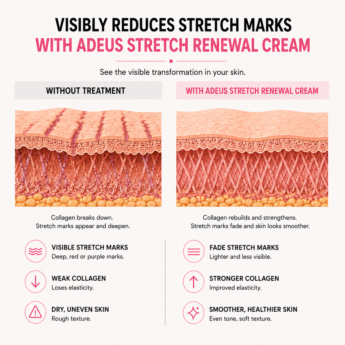 Adeus™ Stretch Renewal Cream