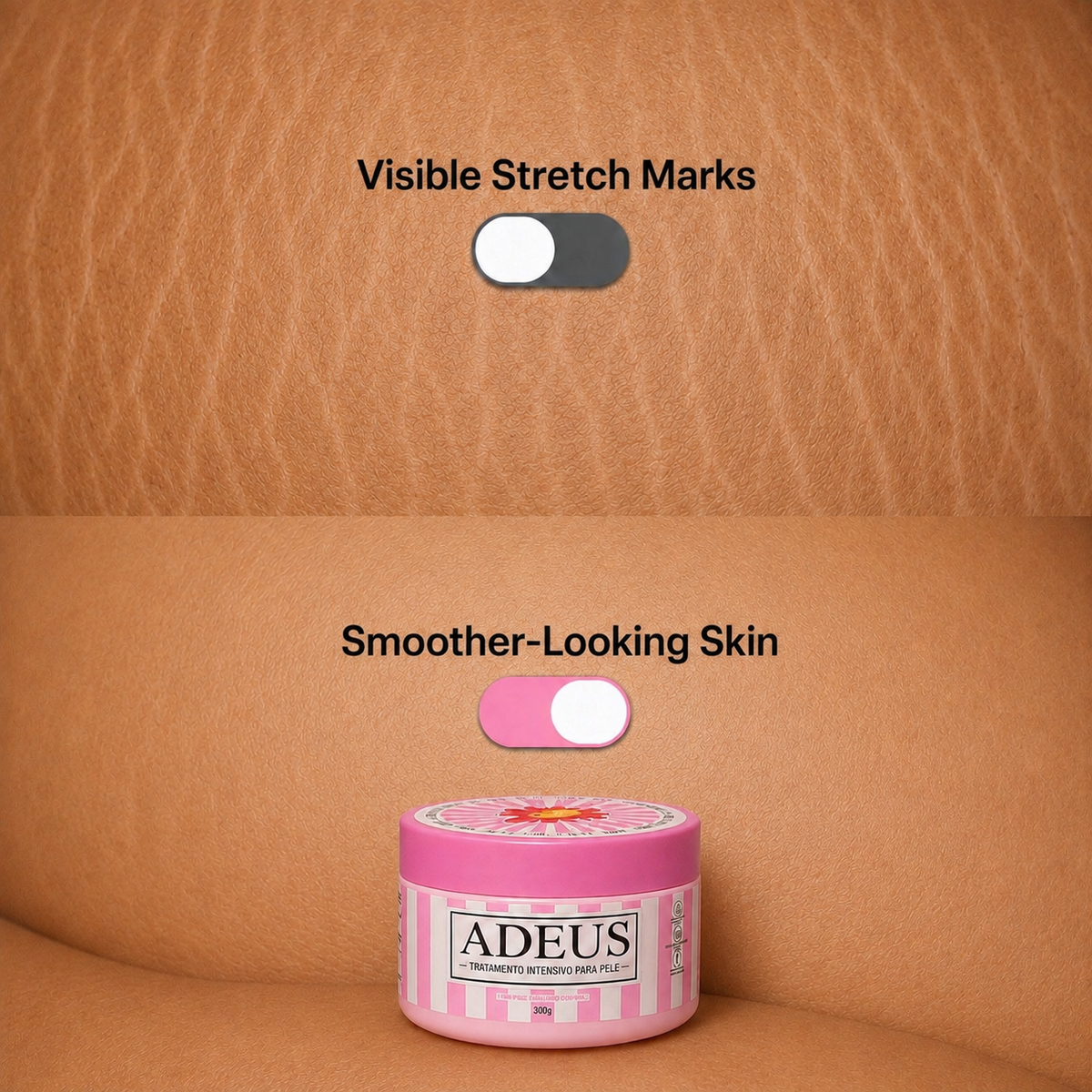 Adeus™ Stretch Renewal Cream