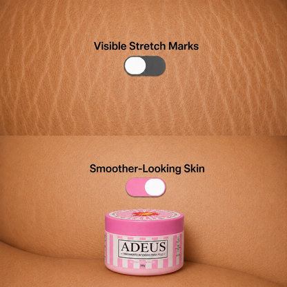 Adeus™ Stretch Renewal Cream