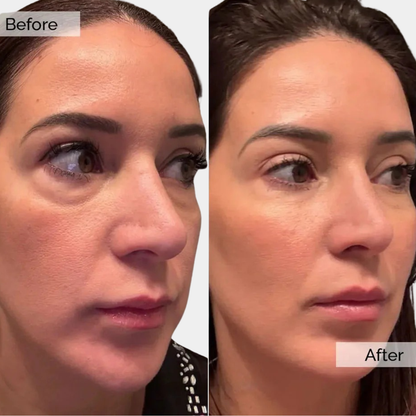 Aluxe LiftPeptide Ampoule