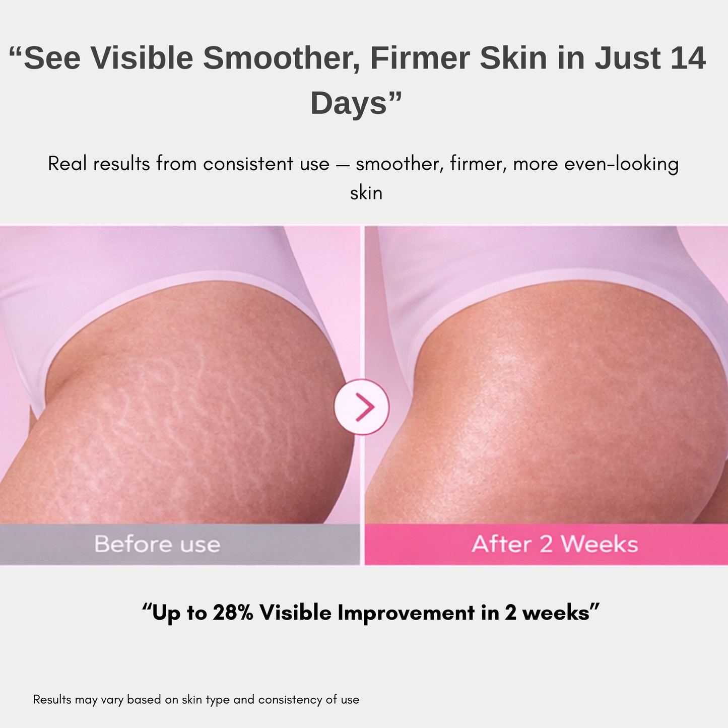 Skin Sculpting & Stretch Repair Treatment Cream