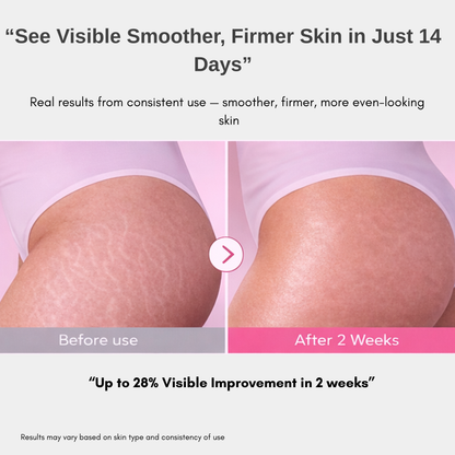 Skin Sculpting & Stretch Repair Treatment Cream