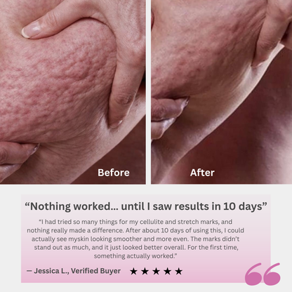 Skin Sculpting & Stretch Repair Treatment Cream