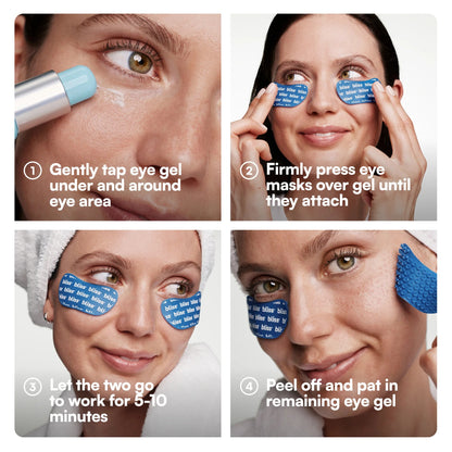 Aluxe™ Micro-Cupping Eye System